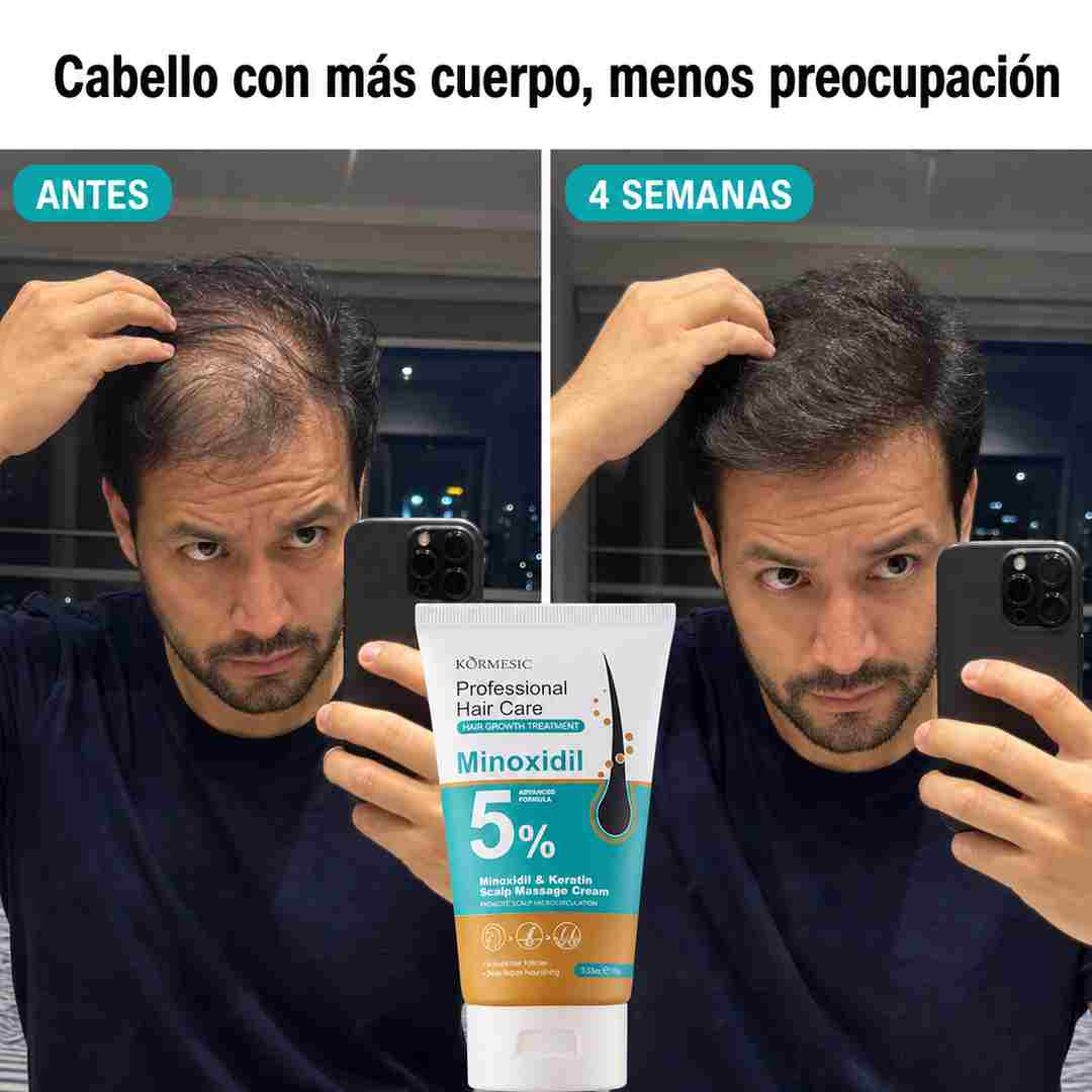 Crema Capilar KORMESIC - Cuero Cabelludo Activado y Mas Cuerpo - Descuento Especial Hoy