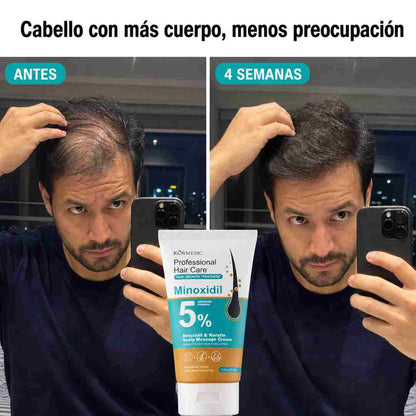 Crema Capilar KORMESIC - Cuero Cabelludo Activado y Mas Cuerpo - Descuento Especial Hoy